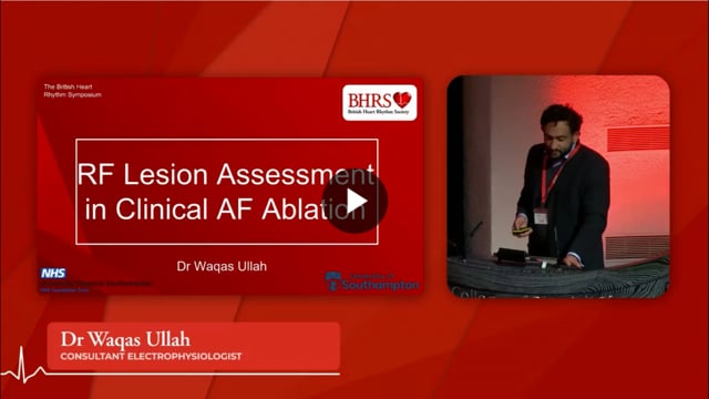 PREVIEW RF Lesion assessment in clinical AF ablation - Waqas Ullah