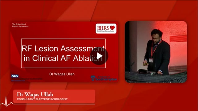 PREVIEW RF Lesion assessment in clinical AF ablation - Waqas Ullah