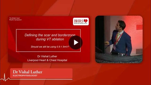 PREVIEW Defining the scar and borderzone during VT ablation - Vishal Luther
