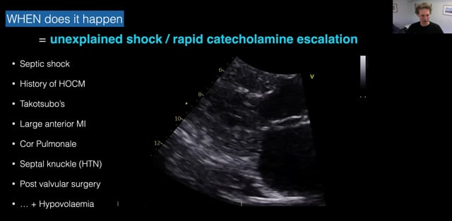 Dynamic LVOT obstruction both cause and effect in septic shock