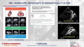 Transesophageal echo as a tool for realtime optimization in CPR.
