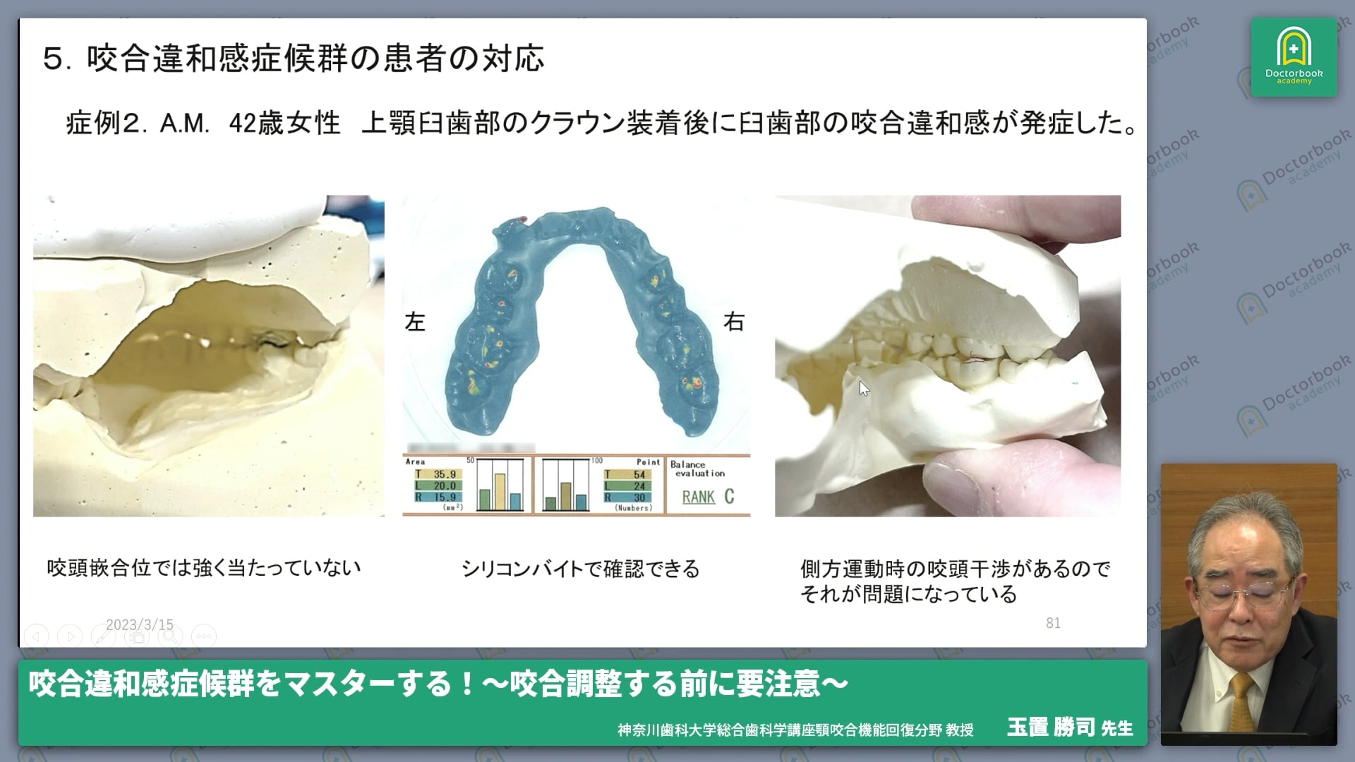 【後編】咬合違和感症候群の症例対応はどうする？ #4