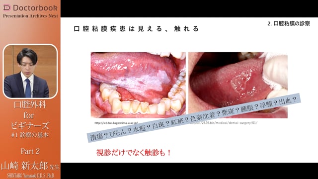 口腔粘膜の診察 #2