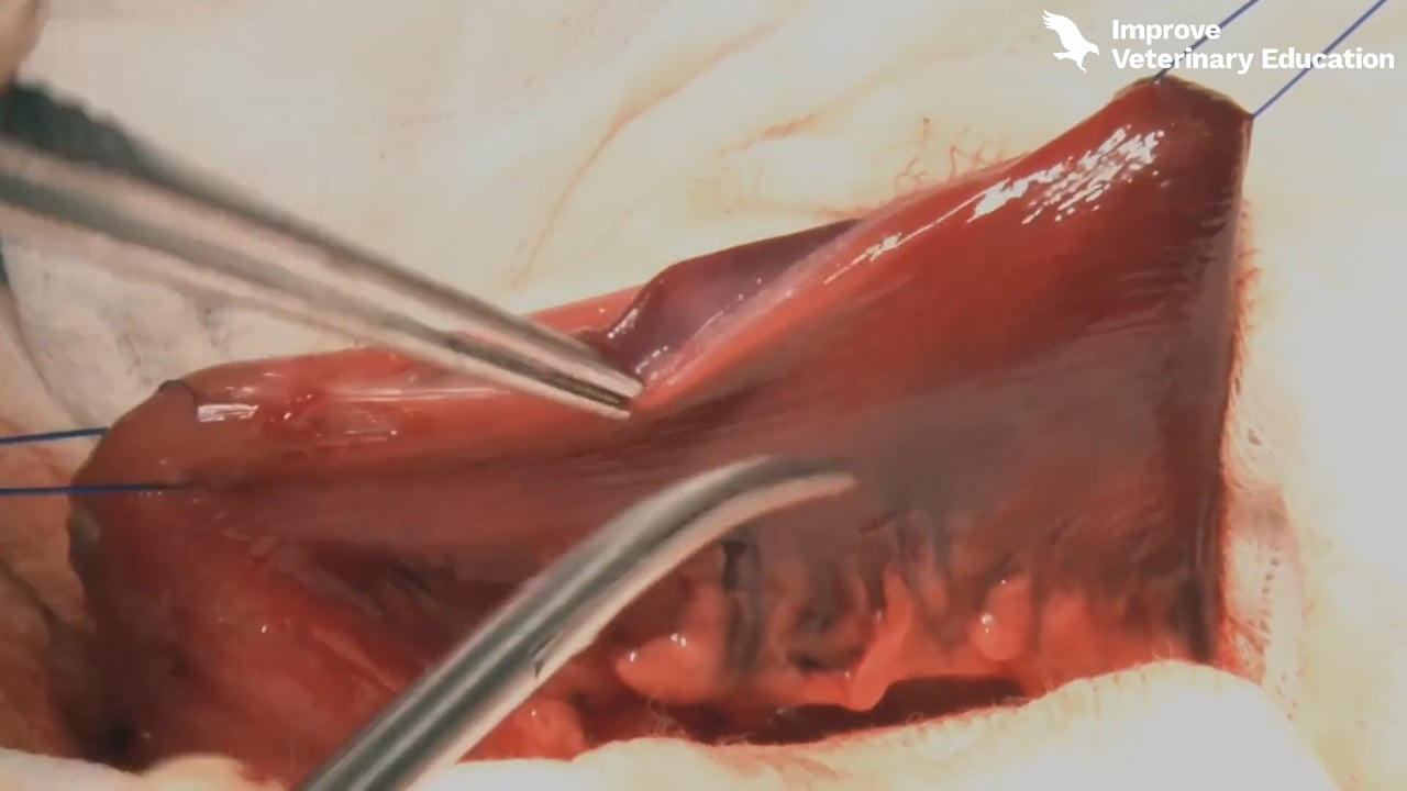 Gastrotomy