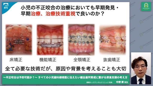 なぜ小児の摂食支援が重要なのか #1