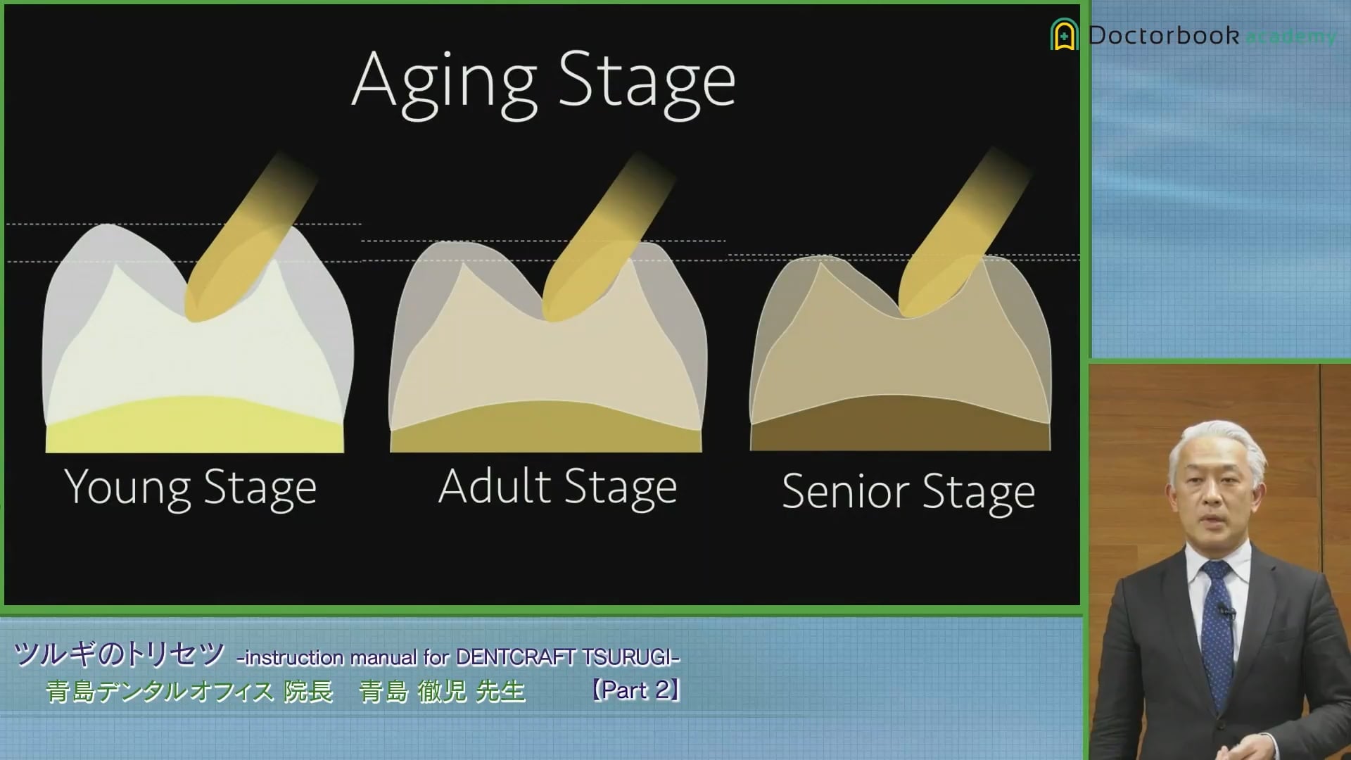 臨床知見録_ダイレクトボンディング_歯牙のAging stageとの関連