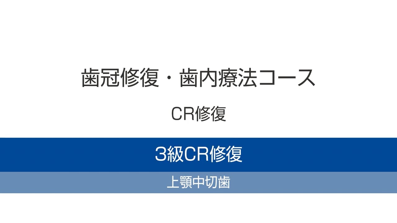 臨床知見録_ダイレクトボンディング_上顎中切歯の３級CR