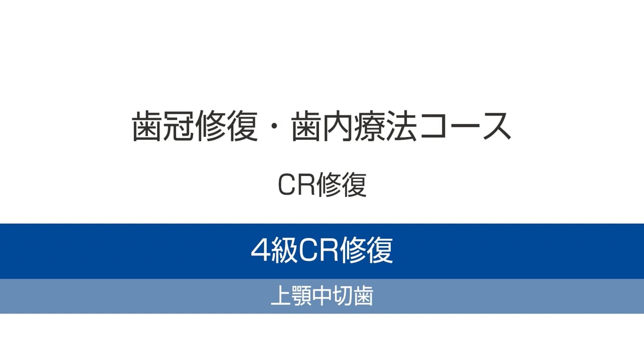 臨床知見録_ダイレクトボンディング_上顎中切歯の４級CR