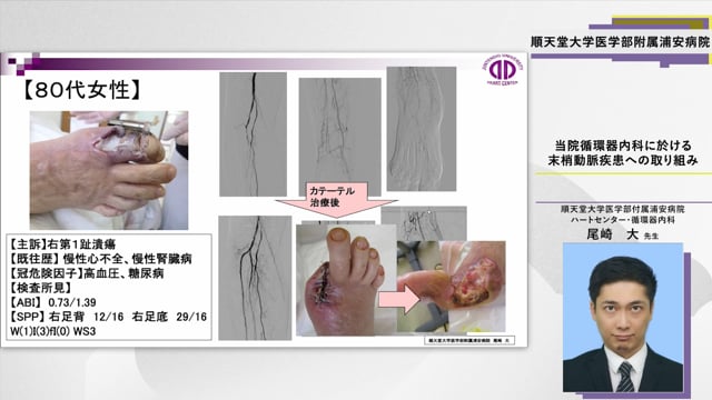 当院循環器内科に於ける末梢動脈疾患への取り組み