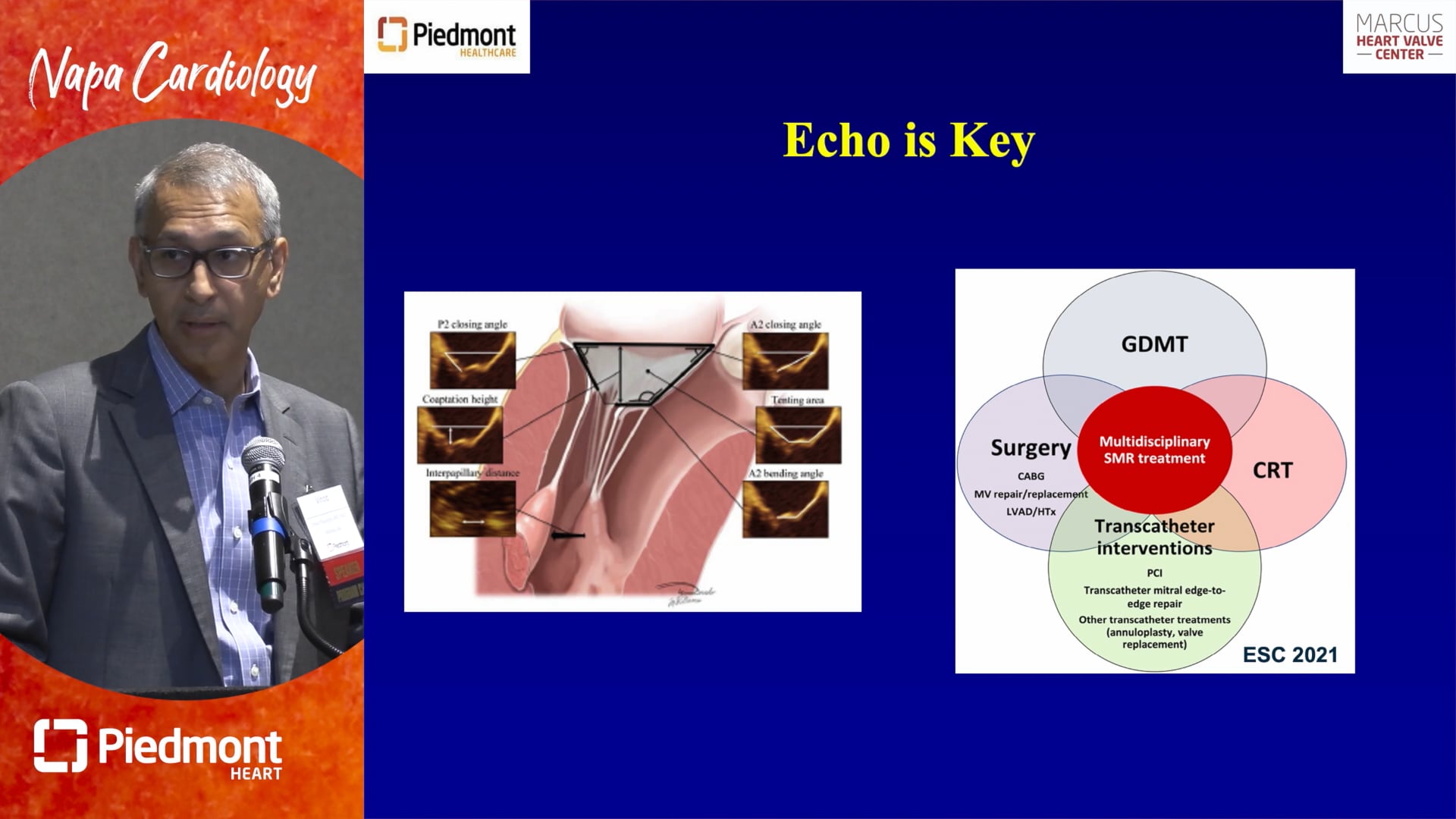 Piedmont Heart Institute - 80 Yo Old With MR: Heart Team Decision ...