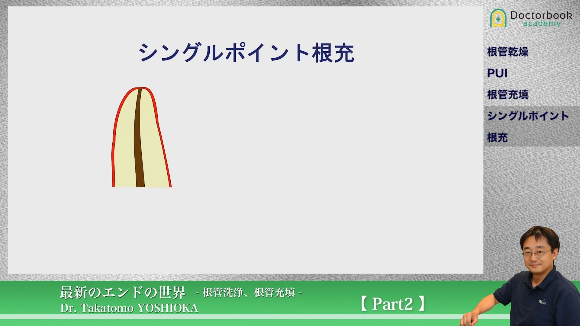 臨床知見録_根管充塡_シングルポイント根充