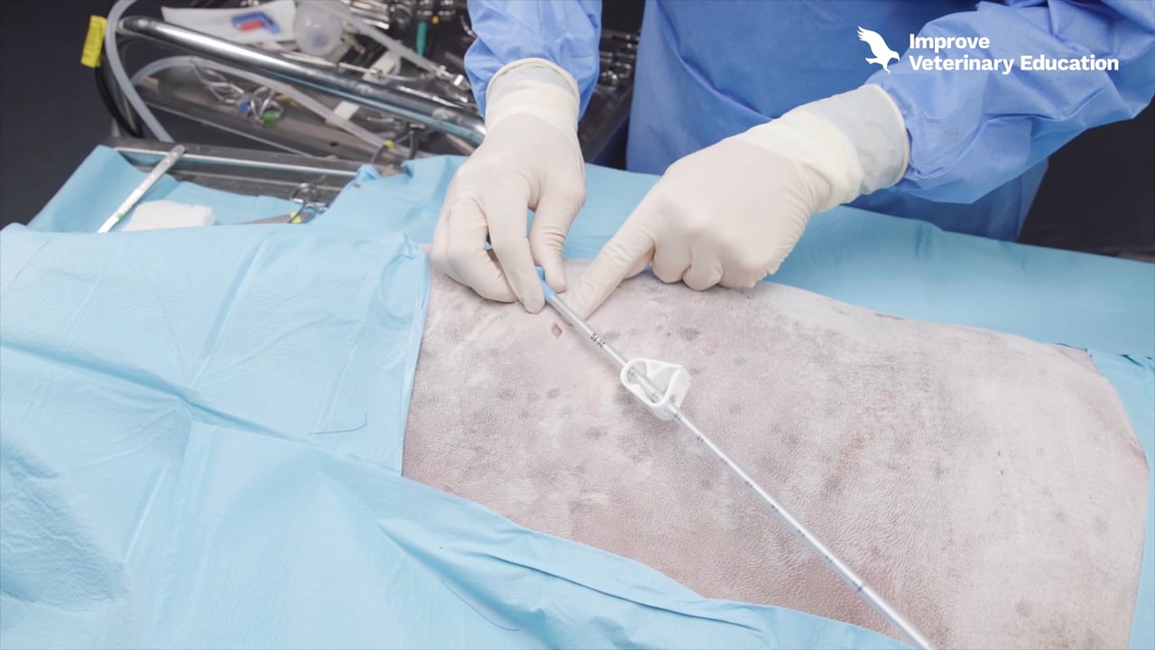 Thoracic drain placement- Trocar