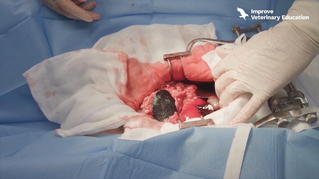 Exploratory laparotomy