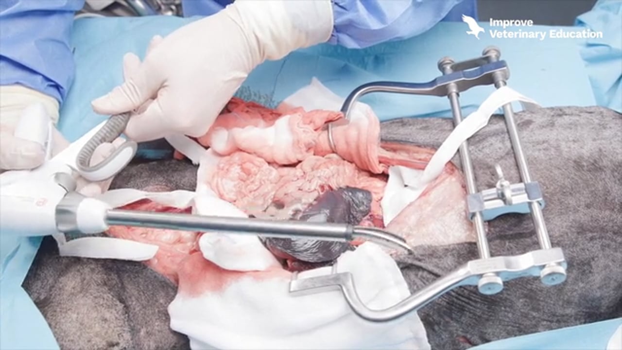 Emergency splenectomy