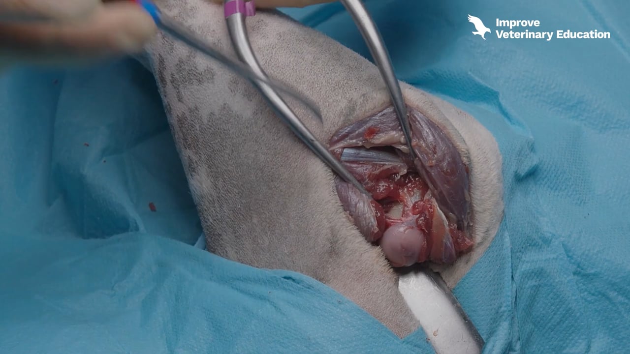Arthroplasty of the head and neck of the femur