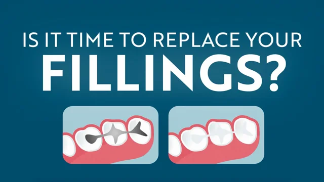 What are Dental Fillings made of? - North Mesquite Dental Group