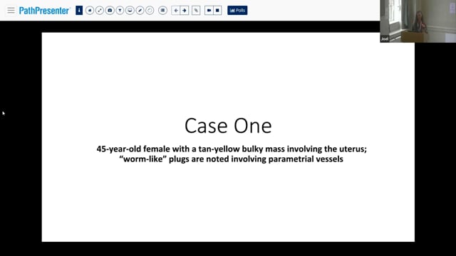 Slide Seminar:  Mesenchymal uterine cases, Prof Marisa Nucci