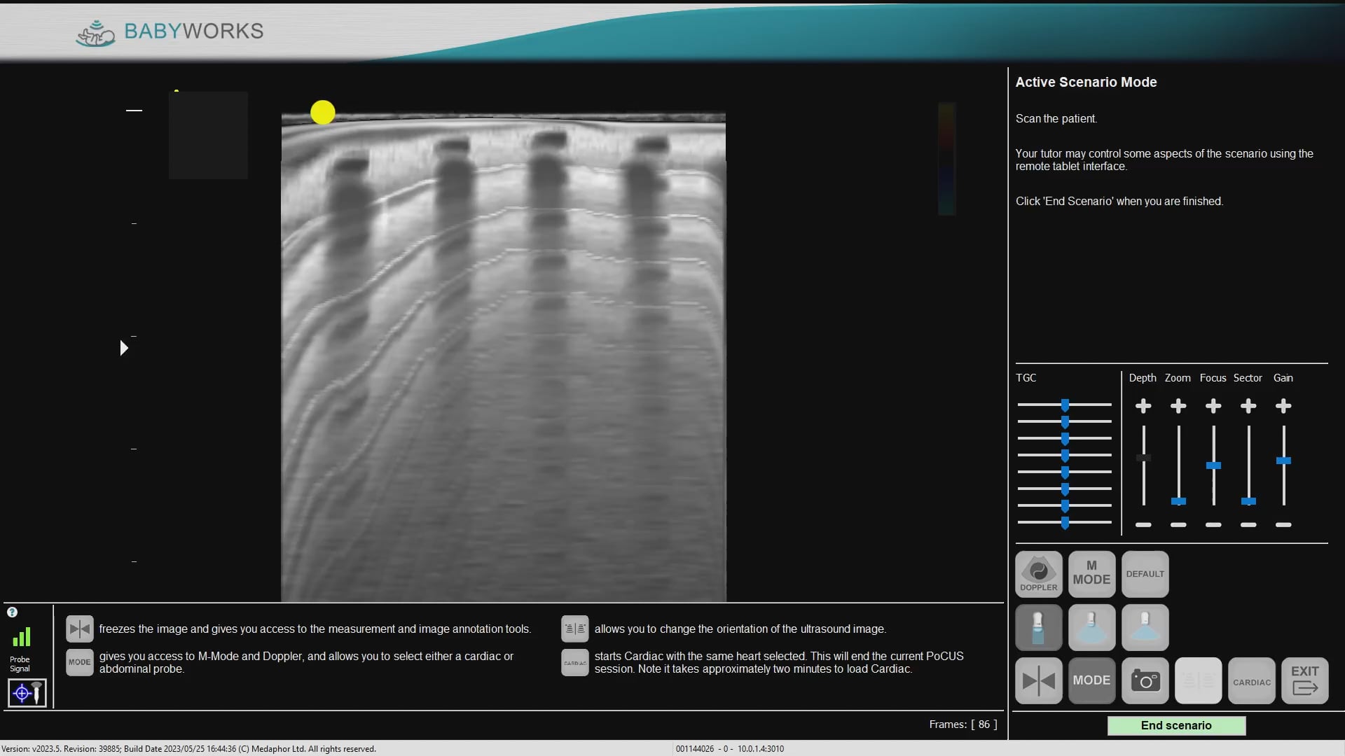 BB normal lung on Vimeo