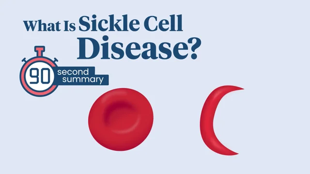 sickle cells