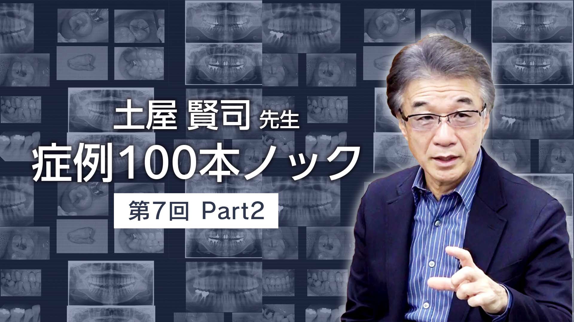 土屋賢司先生 症例100本ノック 第7回 PART2