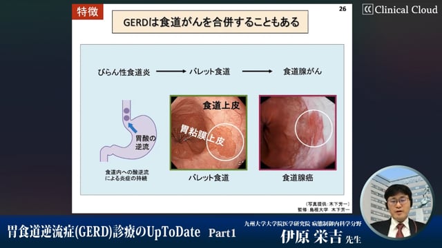 胃食道逆流症(GERD)診療のUpToDate　Part1