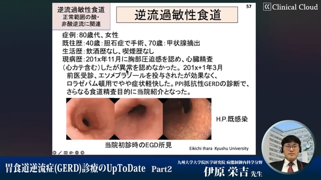 胃食道逆流症(GERD)診療のUpToDate　Part2