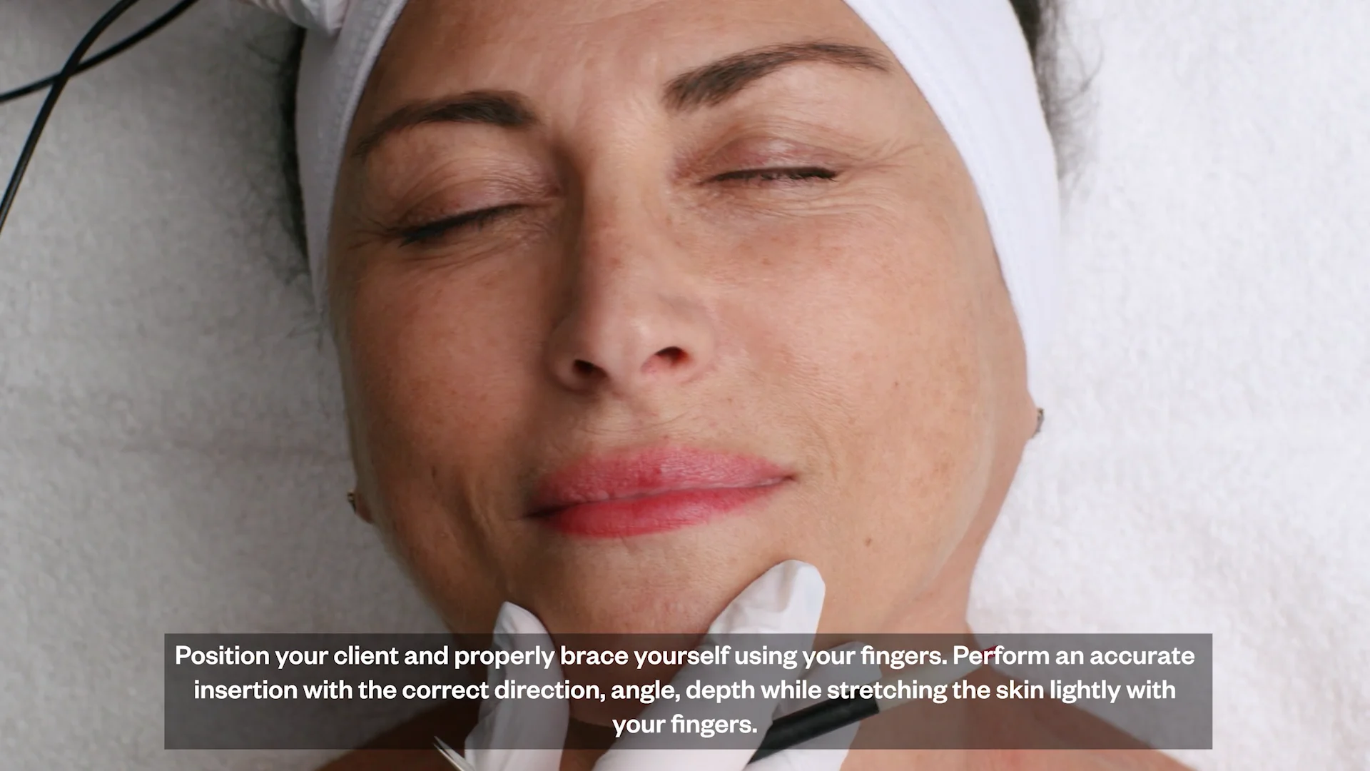 Electrolysis Using the Thermolysis Modality | Videos & Movies on Vimeo