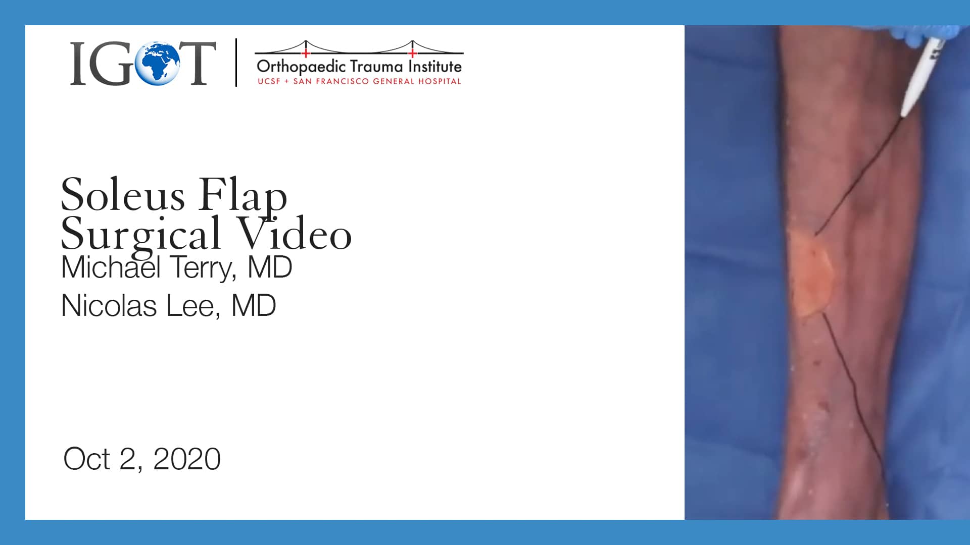 Soleus Flap Surgical Video on Vimeo