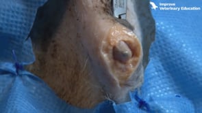 Sacculectomy