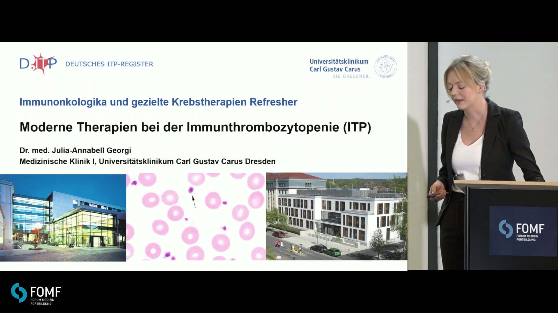 Moderne Therapien in der ITP: Immunmodulation in der Praxis