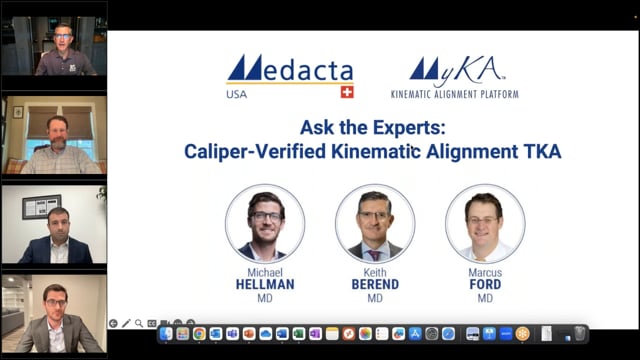 Caliper-Verified Kinematic Alignment TKA using MyKA platform: the experts' experience