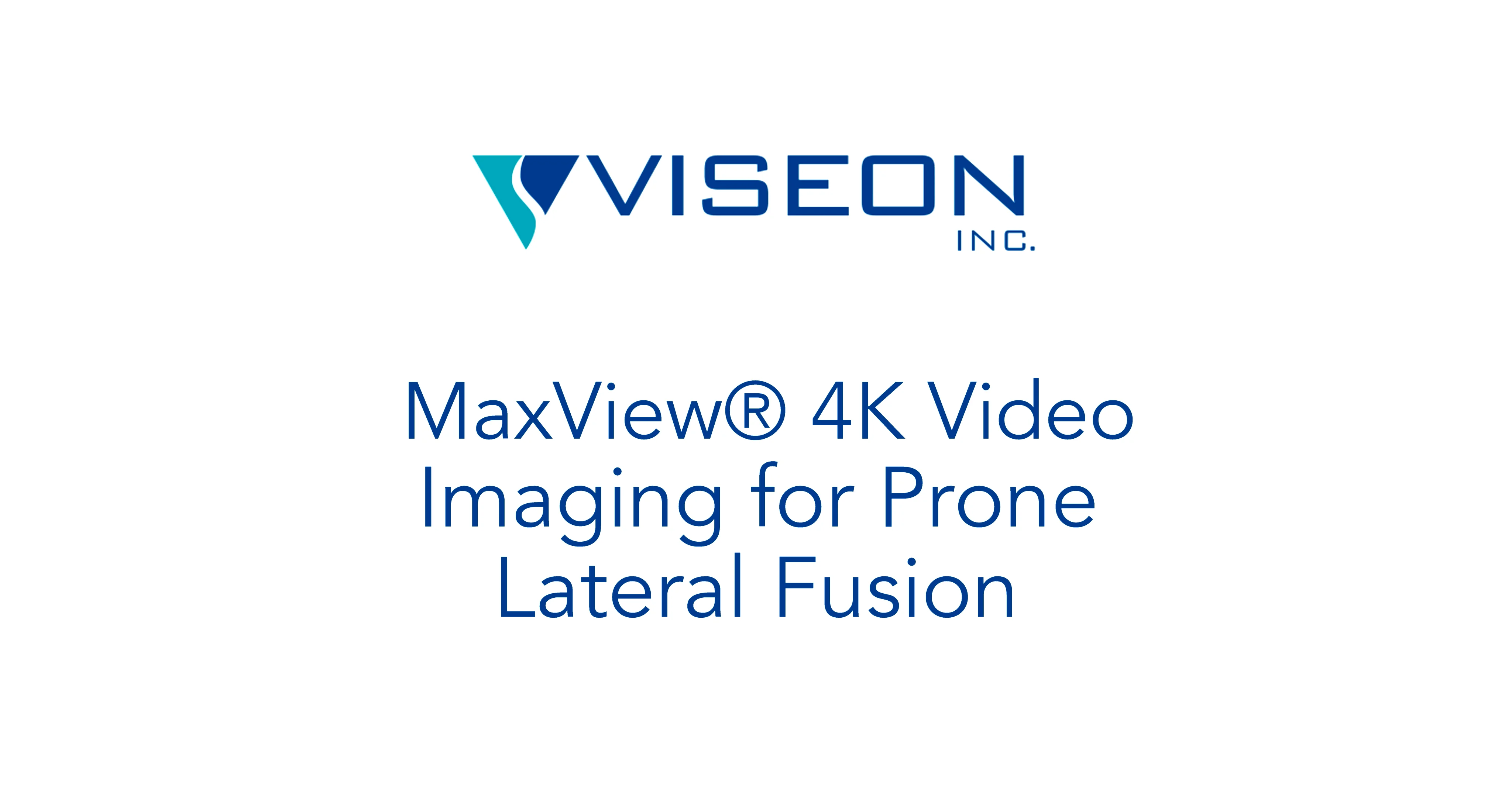 MaxView 4K Demo for Prone Lateral Fusion on Vimeo