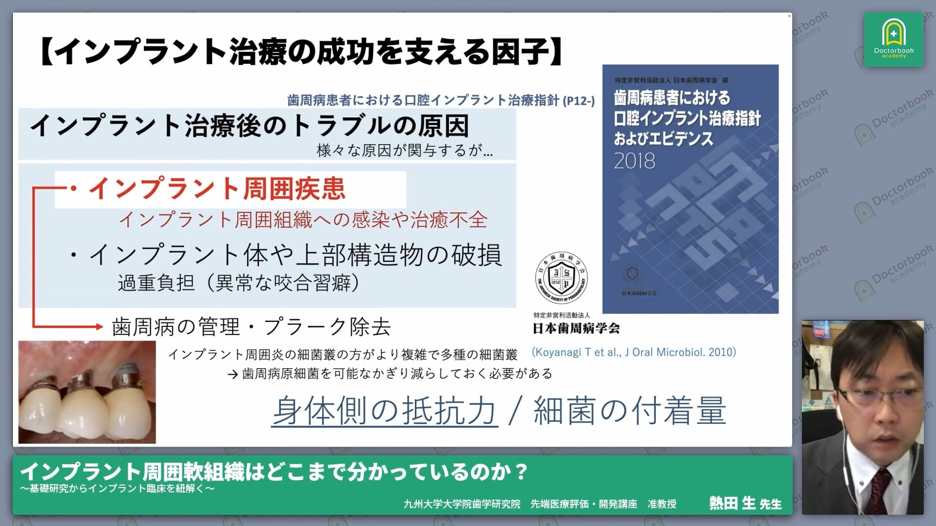 臨床知見録_初めてのインプラント一本埋入_インプラントの長期的予後に関して