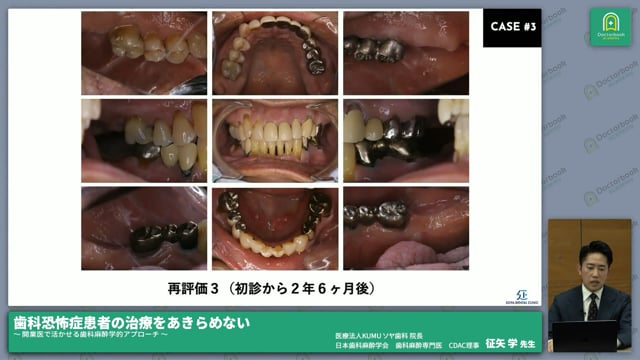 歯科恐怖症患者への対応方法3：薬物的アプローチ-全身麻酔 #6