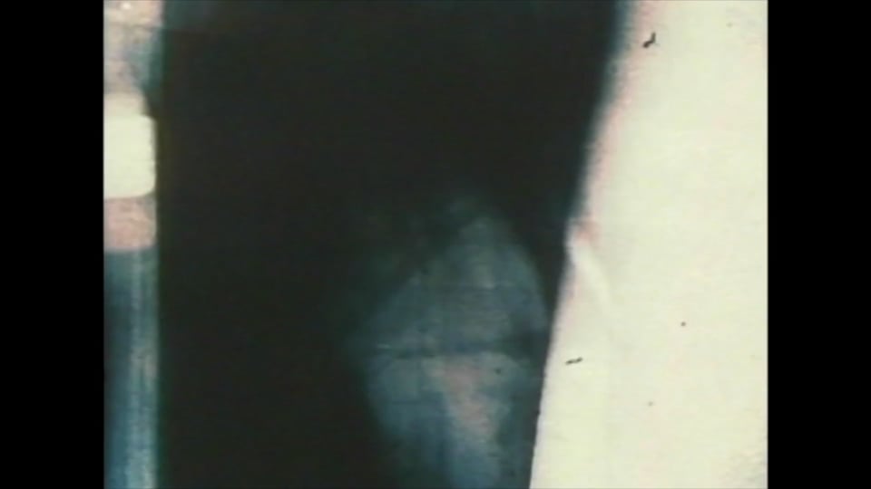 Fissures