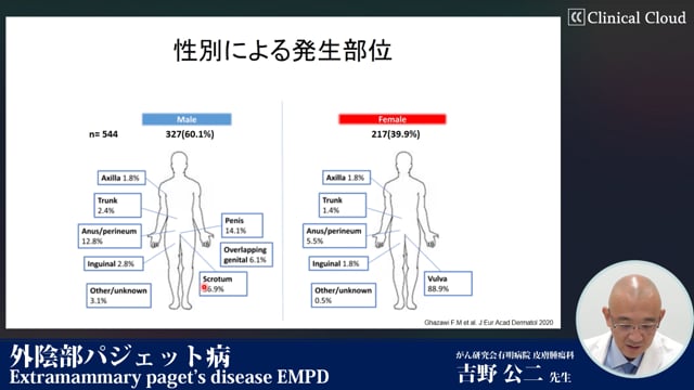 外陰部パジェット病 Extramammary paget's disease EMPD