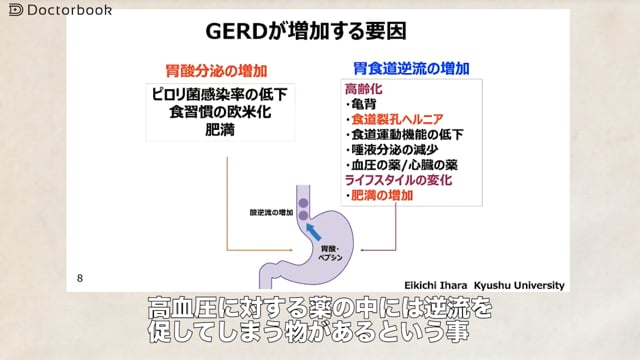 GERDは重症化すると癌になる？日々の生活習慣を見直していくことが 大切