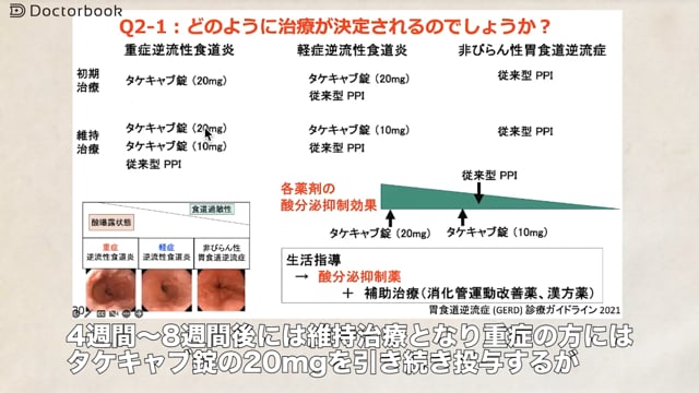 GERDのリスクとなる様々な因子、診断方法から治療法まで解説