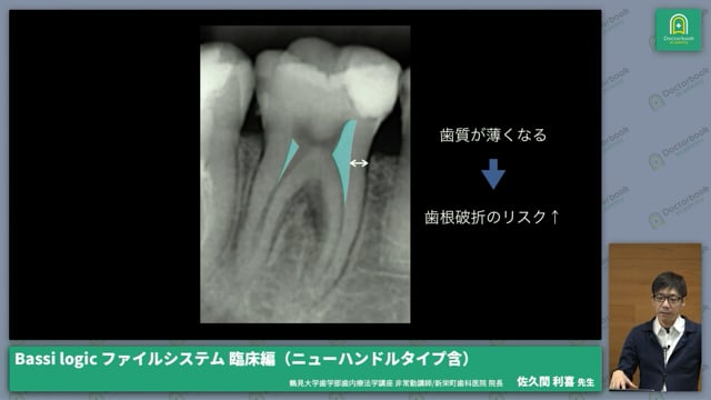 現状の歯内療法の問題点