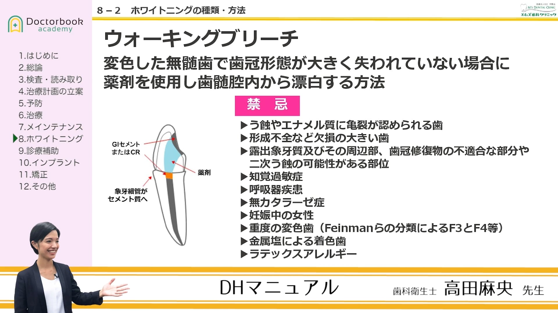 臨床知見録_ホワイトニング_ウォーキングブリーチ