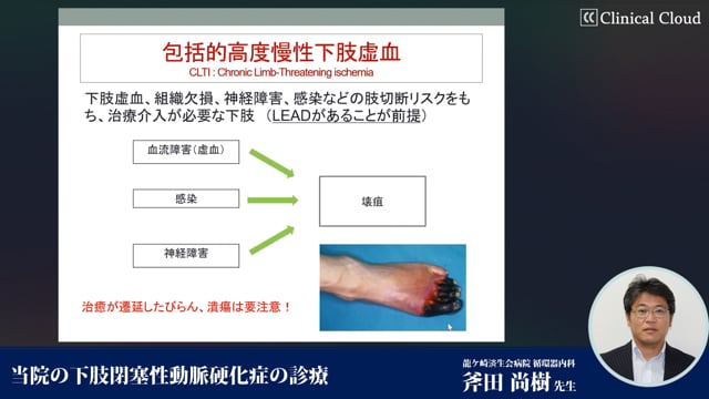 当院の下肢閉塞性動脈硬化症の診療