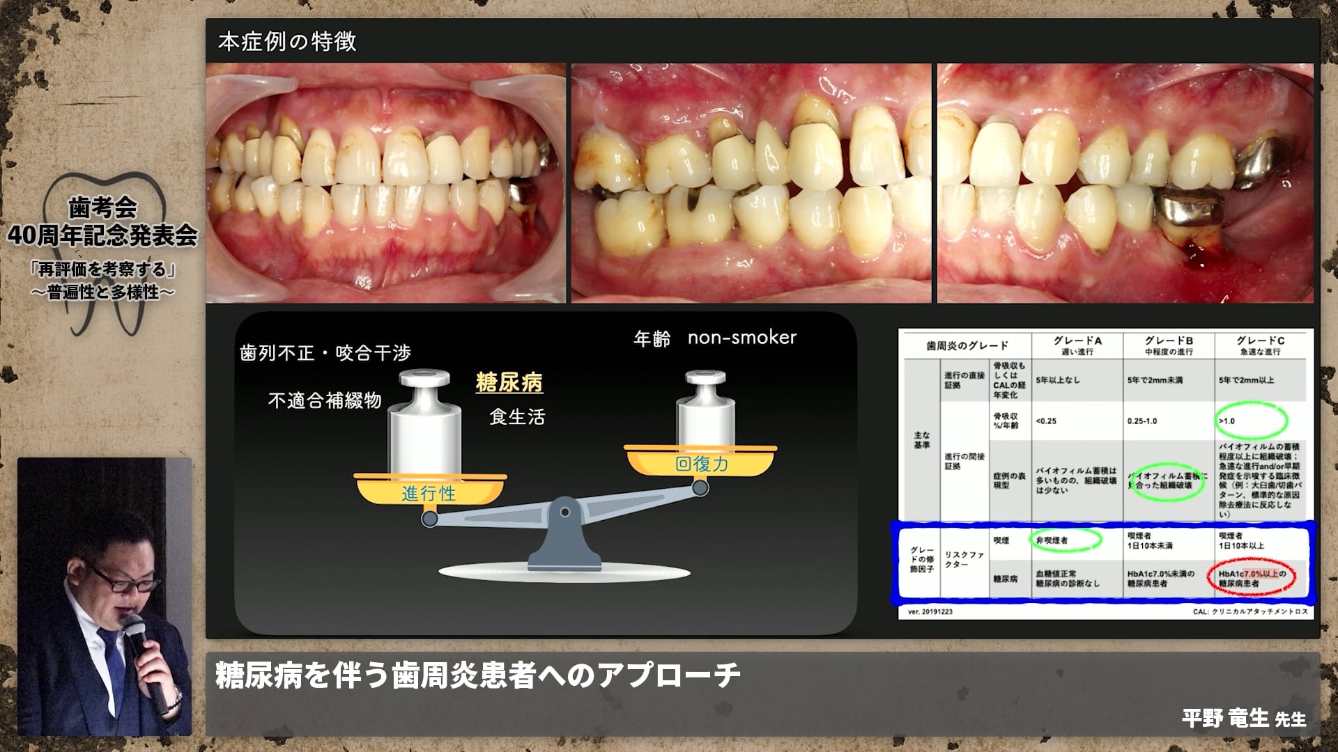 【ペリオ班】糖尿病を伴う歯周炎患者へのアプローチ│平野 竜生先生