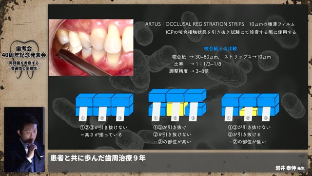 【ペリオ班】患者と共に歩んだ歯周治療9年│岩井 泰伸先生