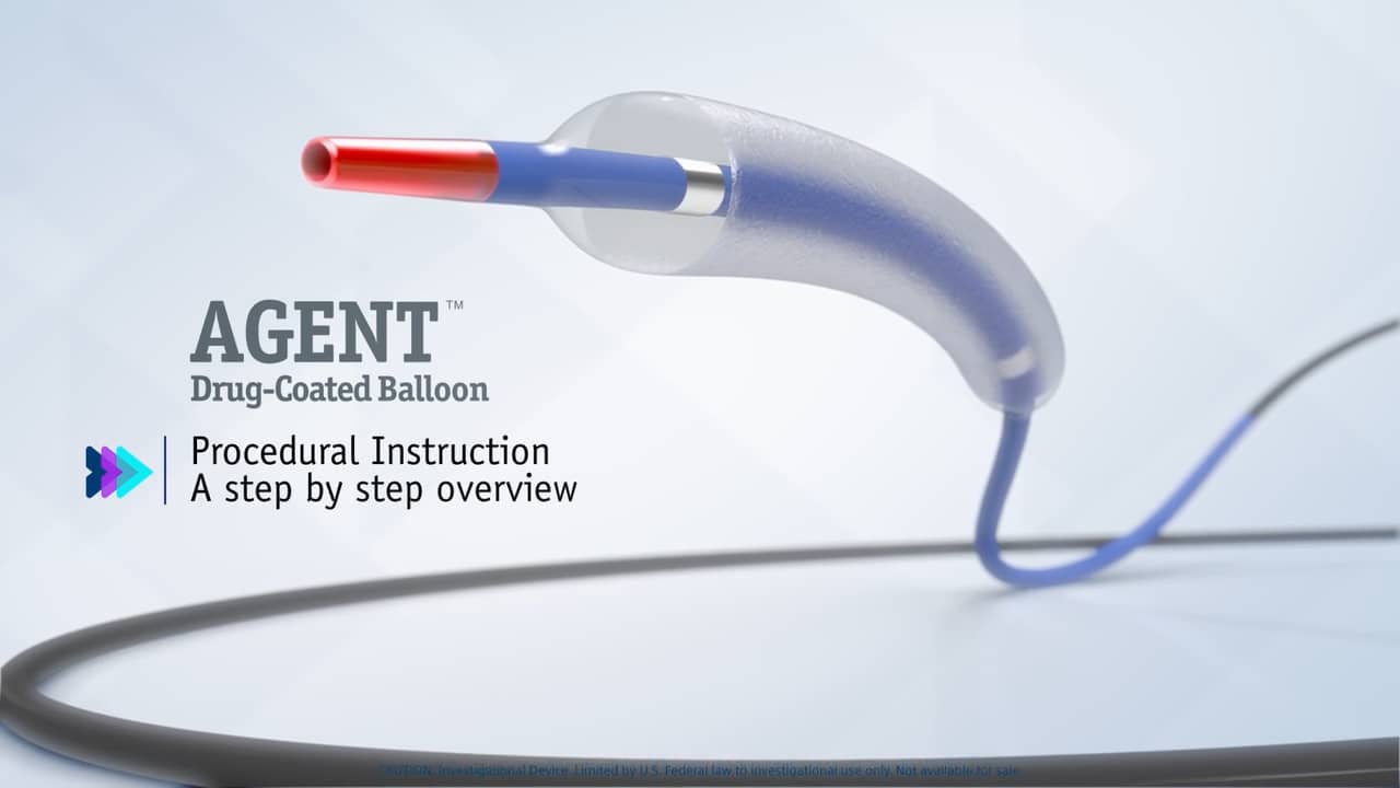 AGENT™ Drug-Coated Balloon Procedural Animation - Boston Scientific on ...