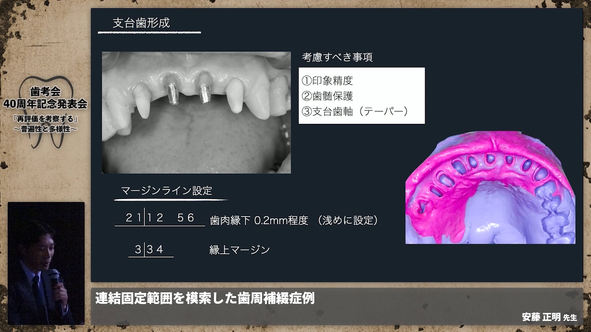 PRECISION IN DENTAL ESTHETICS 歯科 本 補綴歯科 - 健康/医学