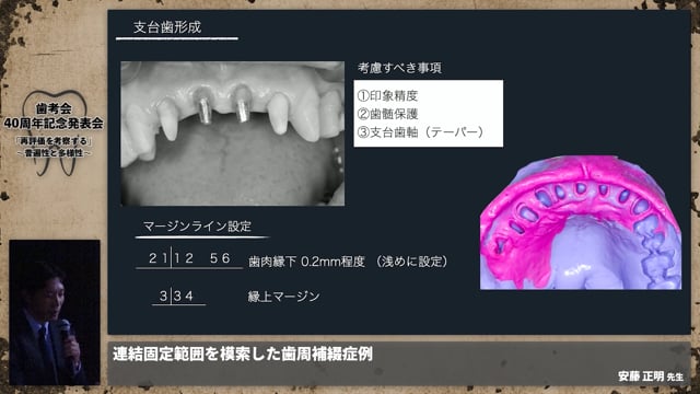 【補綴班】連結固定範囲を模索した歯周補綴症例│安藤 正明先生