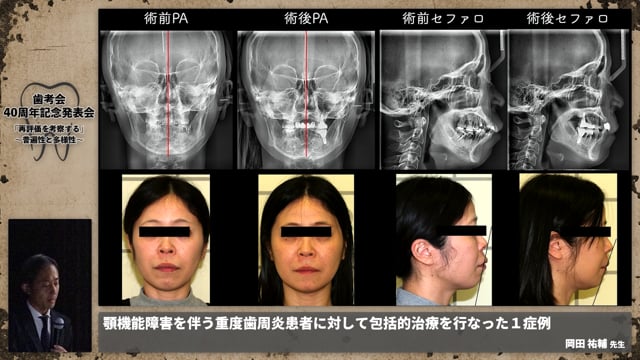 歯考会40周年記念発表会「再評価を考察する～普遍性と多様性