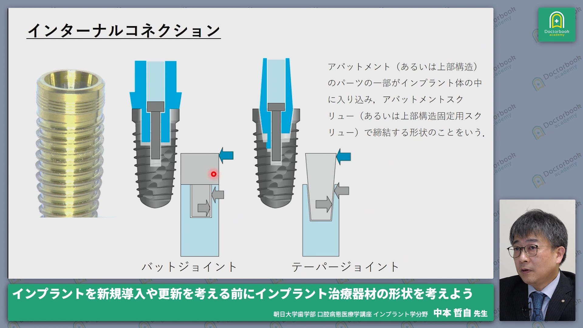 インプラントの新規導入や更新を考える前にインプラント治療器材の形状を考えよう