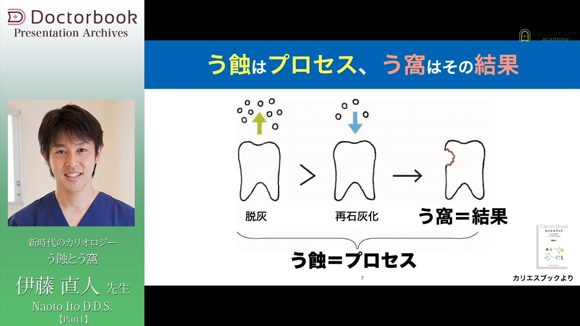 臨床知見録_予防_う蝕とう窩の違い