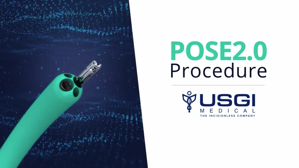 USGI POSE Procedure on Vimeo